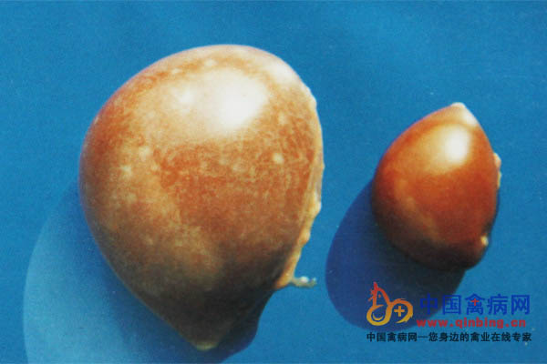 63岁,脾脏肿大,门,静脉增宽,8号手术,术前贫血,